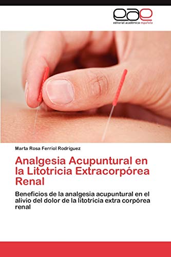 Beispielbild fr Analgesia Acupuntural En La Litotricia Extracorporea Renal zum Verkauf von Chiron Media