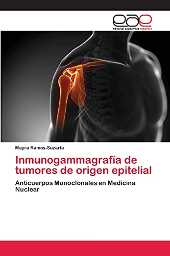 9783659061844: Inmunogammagrafa de tumores de origen epitelial: Anticuerpos Monoclonales en Medicina Nuclear