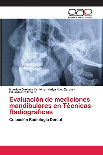 9783659066702: Evaluacin de mediciones mandibulares en Tcnicas Radiogrficas: Coleccin Radiologa Dental (Spanish Edition)