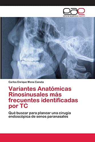 Imagen de archivo de Variantes Anatomicas Rinosinusales mas frecuentes identificadas por TC a la venta por Chiron Media