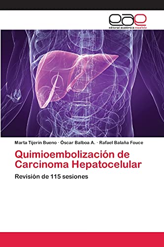 9783659076480: Quimioembolizacin de Carcinoma Hepatocelular: Revisin de 115 sesiones