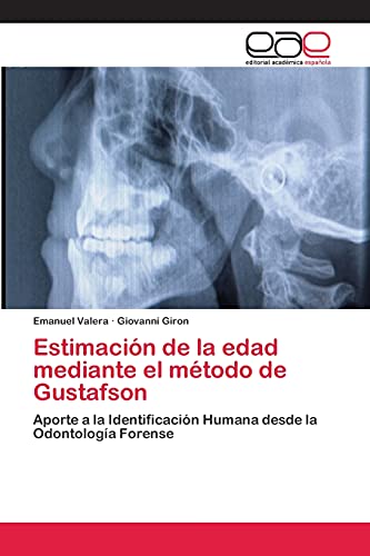 9783659082863: Estimacin de la edad mediante el mtodo de Gustafson: Aporte a la Identificacin Humana desde la Odontologa Forense