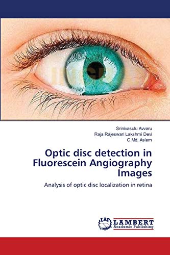 Stock image for Optic disc detection in Fluorescein Angiography Images: Analysis of optic disc localization in retina for sale by Lucky's Textbooks