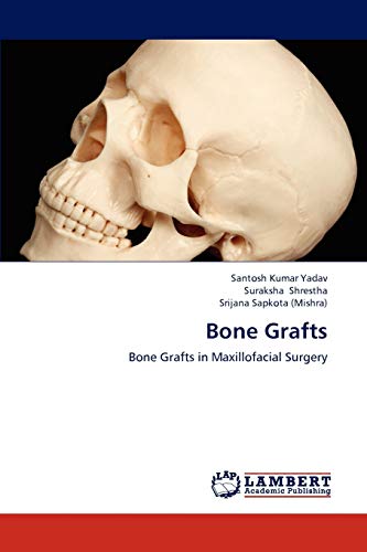 Imagen de archivo de Bone Grafts: Bone Grafts in Maxillofacial Surgery a la venta por Lucky's Textbooks
