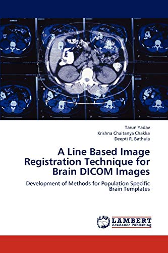A Line Based Image Registration Technique for Brain DICOM Images : Development of Methods for Population Specific Brain Templates - Tarun Yadav