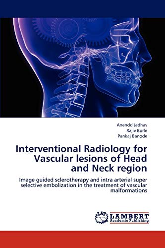 Stock image for Interventional Radiology for Vascular lesions of Head and Neck region: Image guided sclerotherapy and intra arterial super selective embolization in the treatment of vascular malformations for sale by Lucky's Textbooks