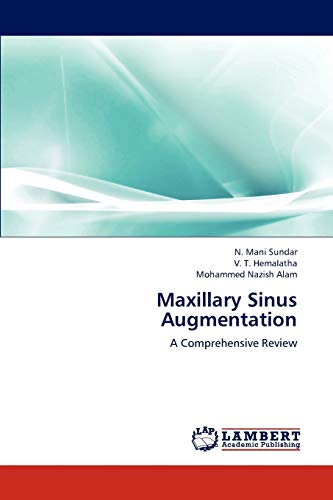 Stock image for Maxillary Sinus Augmentation: A Comprehensive Review for sale by Lucky's Textbooks