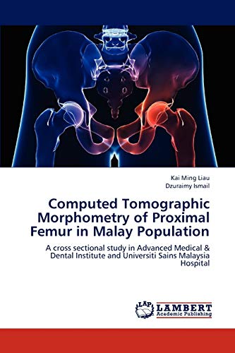 Stock image for Computed Tomographic Morphometry of Proximal Femur in Malay Population: A cross sectional study in Advanced Medical & Dental Institute and Universiti Sains Malaysia Hospital for sale by Lucky's Textbooks