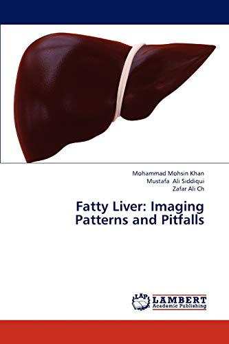 Imagen de archivo de Fatty Liver: Imaging Patterns and Pitfalls a la venta por Lucky's Textbooks