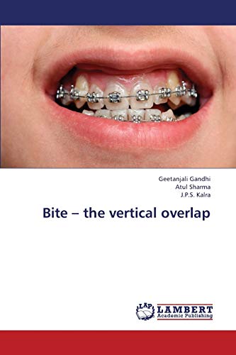 Imagen de archivo de Bite ? the vertical overlap a la venta por Lucky's Textbooks
