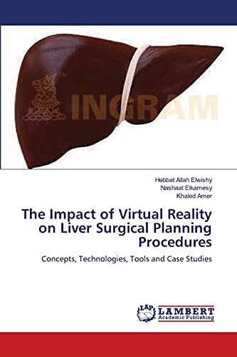 Imagen de archivo de The Impact of Virtual Reality on Liver Surgical Planning Procedures: Concepts, Technologies, Tools and Case Studies a la venta por Lucky's Textbooks