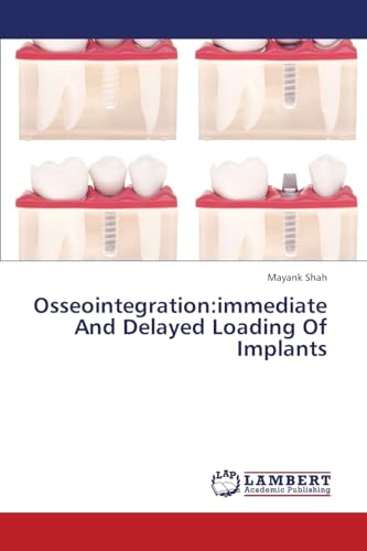 Stock image for Osseointegration:immediate And Delayed Loading Of Implants for sale by Lucky's Textbooks