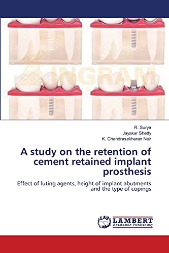 Stock image for A study on the retention of cement retained implant prosthesis: Effect of luting agents, height of implant abutments and the type of copings for sale by Lucky's Textbooks