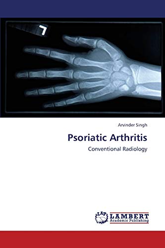 9783659431364: Psoriatic Arthritis: Conventional Radiology