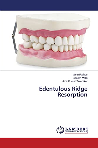 Stock image for Edentulous Ridge Resorption for sale by Lucky's Textbooks