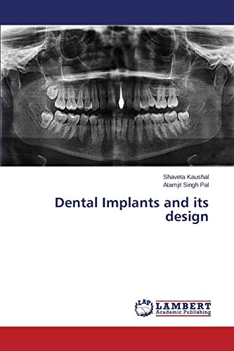 Stock image for Dental Implants and its design for sale by Lucky's Textbooks