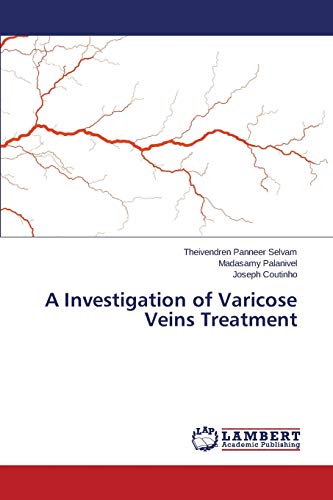 Imagen de archivo de A Investigation of Varicose Veins Treatment a la venta por Lucky's Textbooks