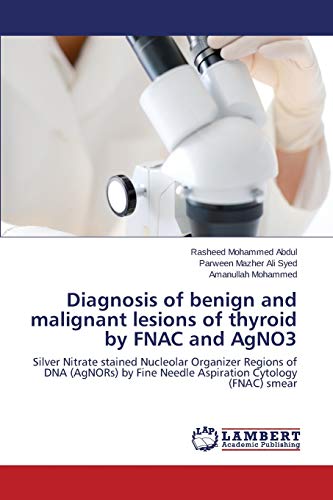 Stock image for Diagnosis of benign and malignant lesions of thyroid by FNAC and AgNO3: Silver Nitrate stained Nucleolar Organizer Regions of DNA (AgNORs) by Fine Needle Aspiration Cytology (FNAC) smear for sale by Lucky's Textbooks