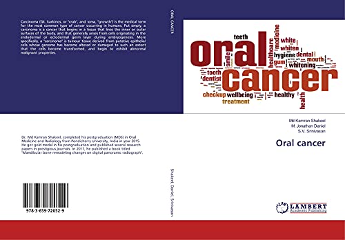 9783659720529: Oral cancer