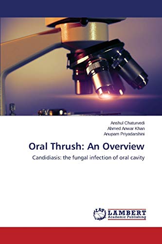 9783659792298: Oral Thrush: An Overview: Candidiasis: the fungal infection of oral cavity