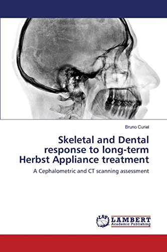 Imagen de archivo de Skeletal and Dental response to long-term Herbst Appliance treatment a la venta por Chiron Media