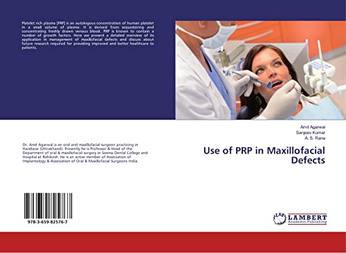 9783659825767: Use of PRP in Maxillofacial Defects