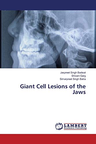 Stock image for Giant Cell Lesions of the Jaws for sale by Lucky's Textbooks