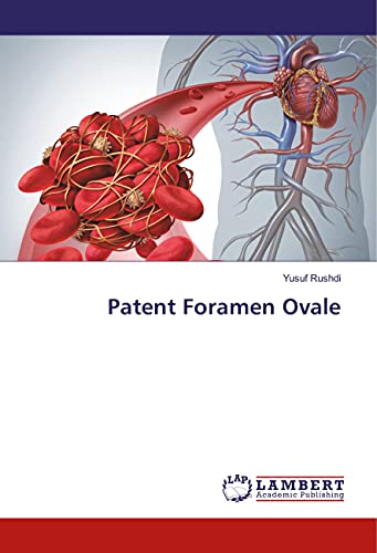 Imagen de archivo de Patent Foramen Ovale a la venta por Chiron Media