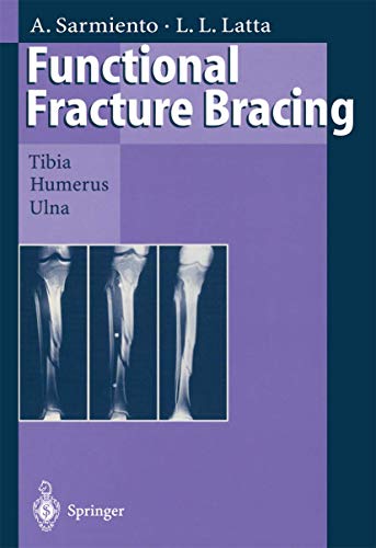 Stock image for Functional Fracture Bracing: Tibia, Humerus, and Ulna for sale by Lucky's Textbooks