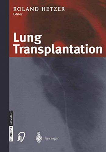 Stock image for Lung Transplantation for sale by Blackwell's