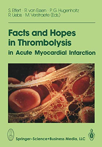 Stock image for Facts and Hopes in Thrombolysis in Acute Myocardial Infarction for sale by Chiron Media