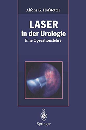 9783662082546: Laser in der Urologie: Eine Operationslehre (German Edition)