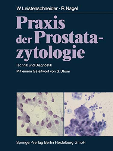 9783662094167: Praxis der Prostatazytologie: Technik Und Diagnostik (German Edition)