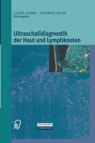 9783662132555: Ultraschalldiagnostik der Haut und Lymphknoten (German Edition)