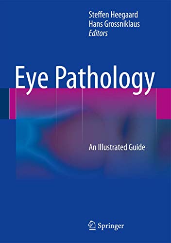 9783662433812: Eye Pathology: An Illustrated Guide