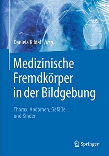 Stock image for Medizinische Fremdkrper in der Bildgebung - Thorax, Abdomen, Gefe und Kinder for sale by medimops