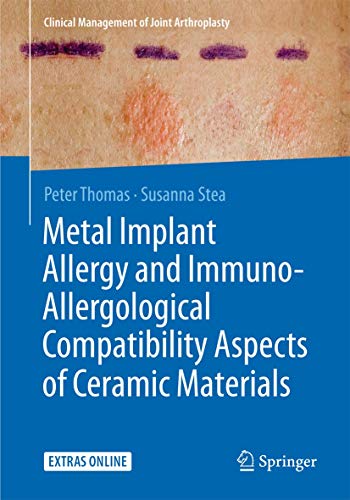 Stock image for Metal Implant Allergy and Immuno-Allergological Compatibility Aspects of Ceramic Materials for sale by Blackwell's