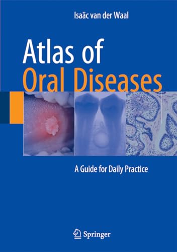 Beispielbild fr Atlas of Oral Diseases: A Guide for Daily Practice [Hardcover] van der Waal, Isac zum Verkauf von SpringBooks