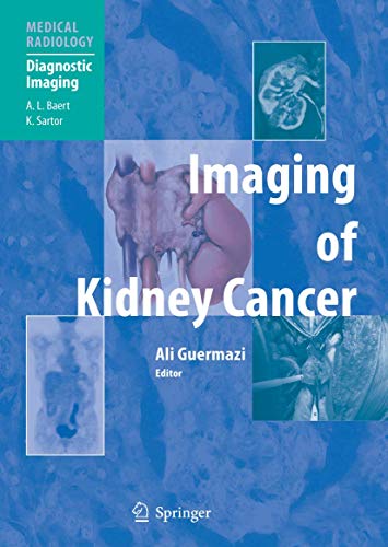9783662500026: Imaging of Kidney Cancer (Medical Radiology)