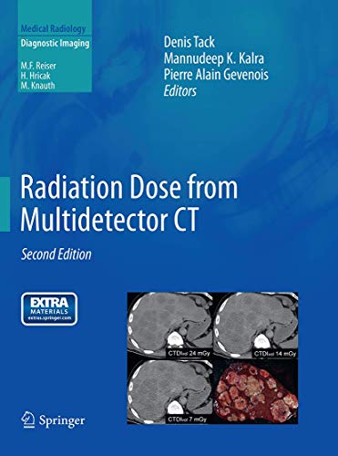 9783662500392: Radiation Dose from Multidetector Ct