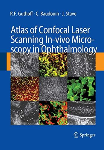 Stock image for Atlas of Confocal Laser Scanning In-vivo Microscopy in Ophthalmology for sale by Lucky's Textbooks