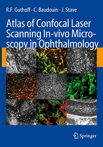 9783662500613: Atlas of Confocal Laser Scanning In-vivo Microscopy in Ophthalmology: Principles and Applications in Diagnostic and Therapeutic Ophtalmology