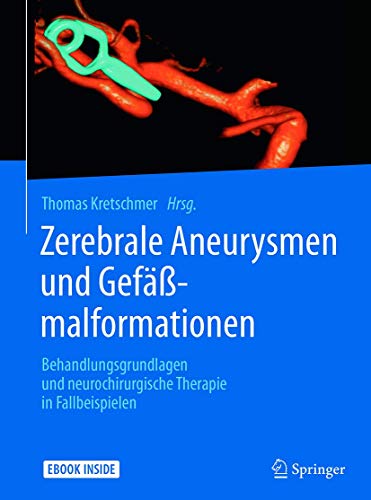 Imagen de archivo de Zerebrale Aneurysmen und Gefmalformationen: Behandlungsgrundlagen und neurochirurgische Therapie in Fallbeispielen a la venta por medimops