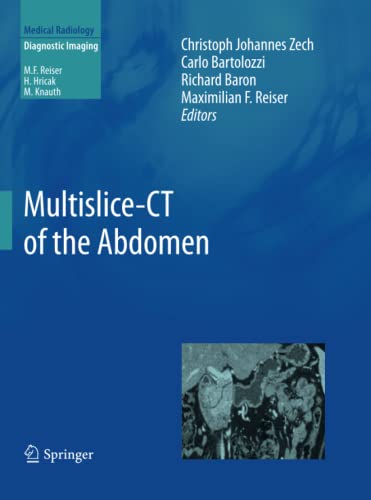9783662506967: Multislice-CT of the Abdomen (Medical Radiology)