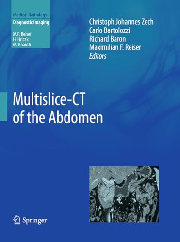 9783662506967: Multislice-CT of the Abdomen