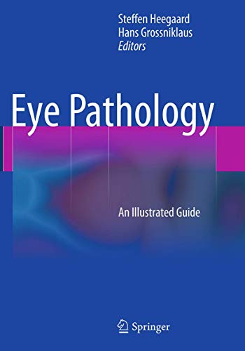 Stock image for Eye Pathology: An Illustrated Guide for sale by Majestic Books