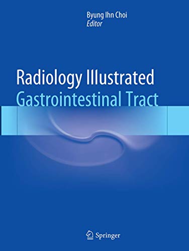 Stock image for Radiology Illustrated: Gastrointestinal Tract for sale by Mispah books