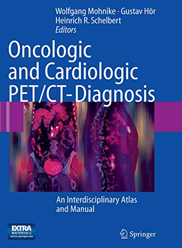 Stock image for Oncologic and Cardiologic PET/CT-Diagnosis : An Interdisciplinary Atlas and Manual for sale by Ria Christie Collections