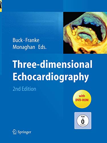 9783662519790: Three-dimensional Echocardiography