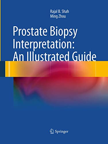 9783662520093: Prostate Biopsy Interpretation: An Illustrated Guide